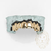 Grillz Haut – Dents Collées – Or/Argent – Poli Miroir
