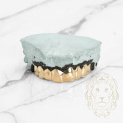 Grillz Haut – Dents Collées – Or/Argent – Poli Miroir