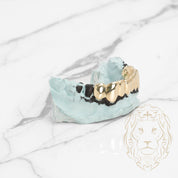 Grillz Bas – Dents Collées – Or/Argent – Poli Miroir