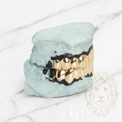 Grillz Haut & Bas – Dents Collées – Or/Argent – Poli Miroir