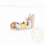 Grillz – 8 Dents Collées – Haut – Or Tricolore – Poli Miroir