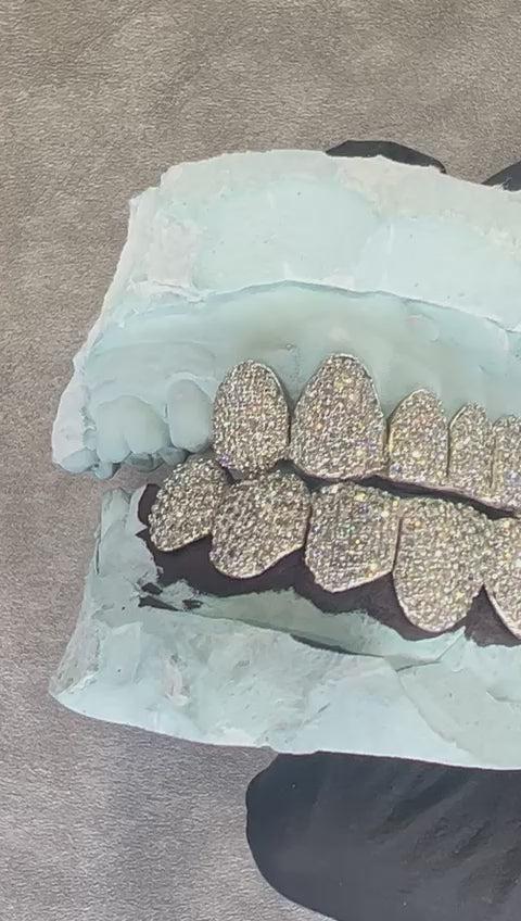 Grillz Bas – Dents Collées – Diamants Naturels & Or – Pavé